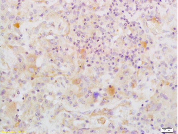 IGFBP2 Antibody in Immunohistochemistry (Paraffin) (IHC (P))