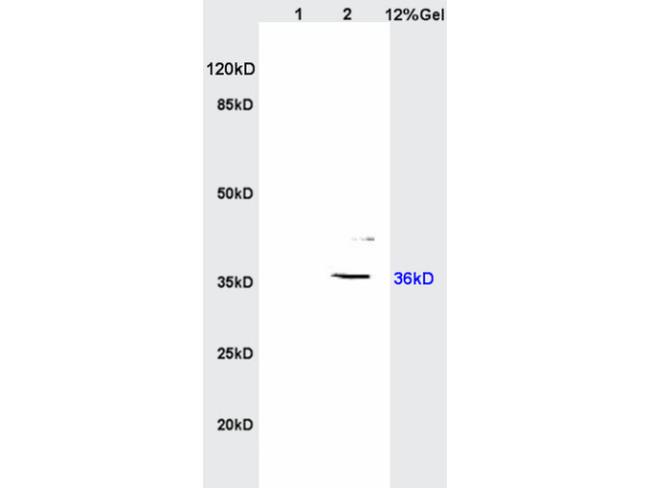 IGFBP2 Antibody in Western Blot (WB)