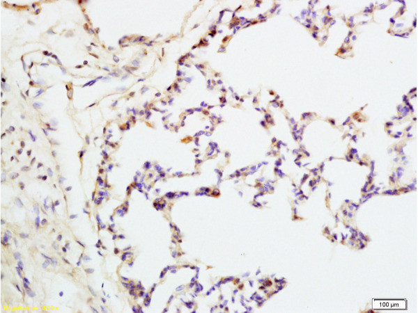 IQGAP1 Antibody in Immunohistochemistry (Paraffin) (IHC (P))