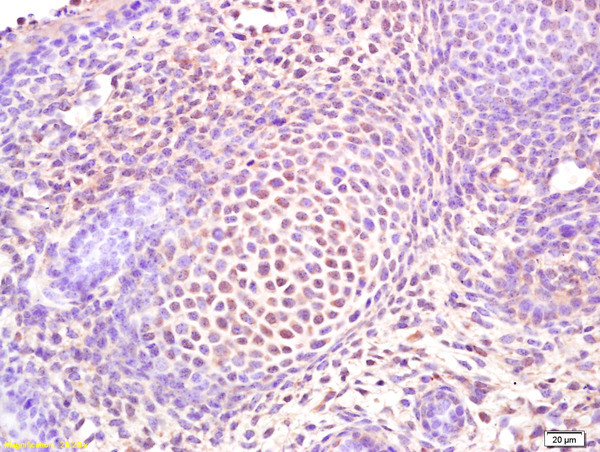 Osterix Antibody in Immunohistochemistry (Paraffin) (IHC (P))