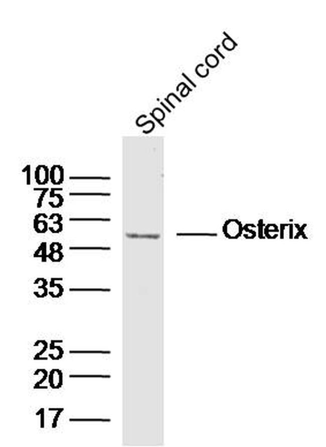 Osterix Antibody in Western Blot (WB)