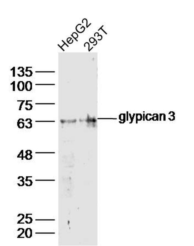 glypican 3 Antibody in Western Blot (WB)