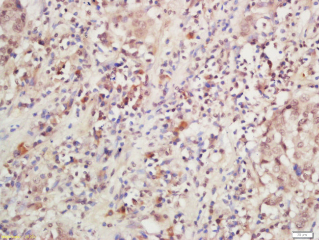 IL-28R Antibody in Immunohistochemistry (Paraffin) (IHC (P))