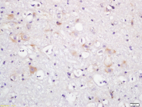 beta Adducin Antibody in Immunohistochemistry (Paraffin) (IHC (P))