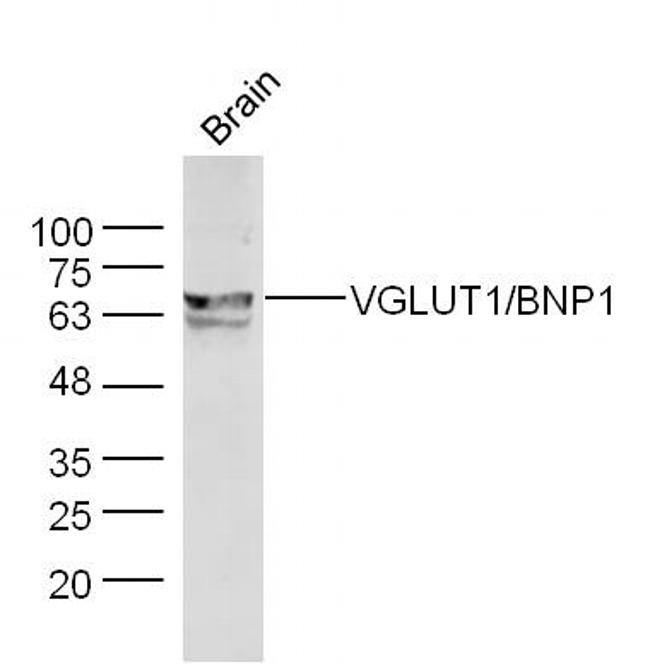 VGLUT1/VGLUT2 Antibody in Western Blot (WB)