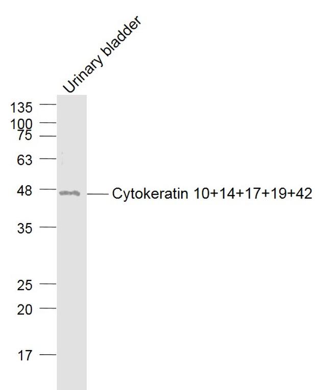 Cytokeratin 10+14+17+19+42 Antibody in Western Blot (WB)