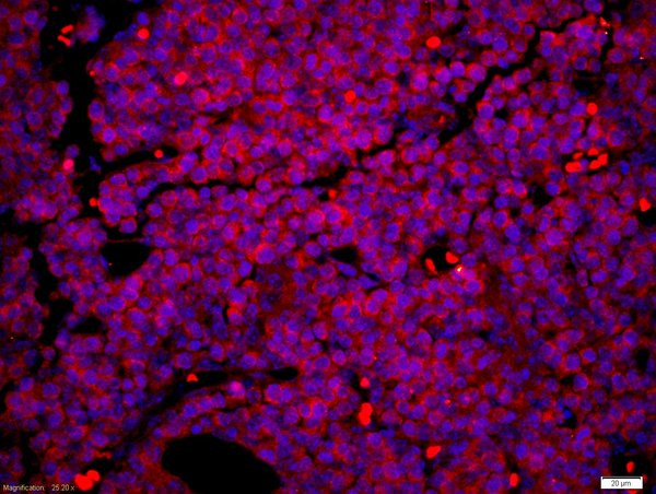 PAX6 Antibody in Immunohistochemistry (Paraffin) (IHC (P))