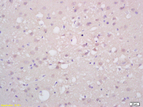 PAX6 Antibody in Immunohistochemistry (Paraffin) (IHC (P))