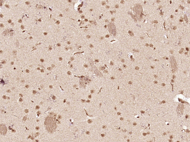 SOX4 Antibody in Immunohistochemistry (Paraffin) (IHC (P))