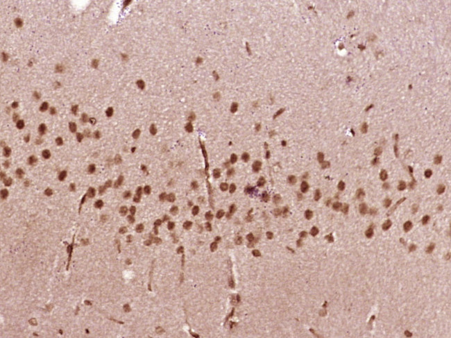 SOX4 Antibody in Immunohistochemistry (Paraffin) (IHC (P))