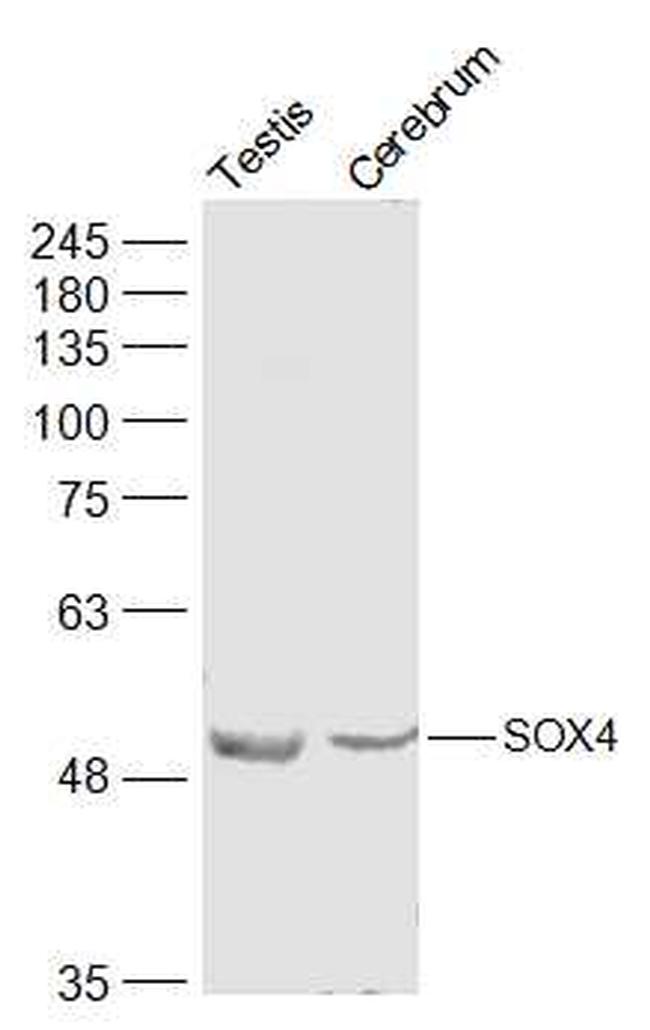 SOX4 Antibody in Western Blot (WB)