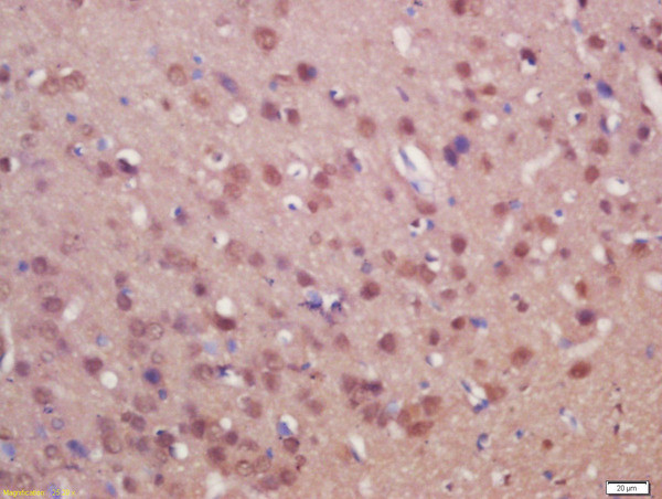 SUFU/Suppressor of Fused Antibody in Immunohistochemistry (Paraffin) (IHC (P))