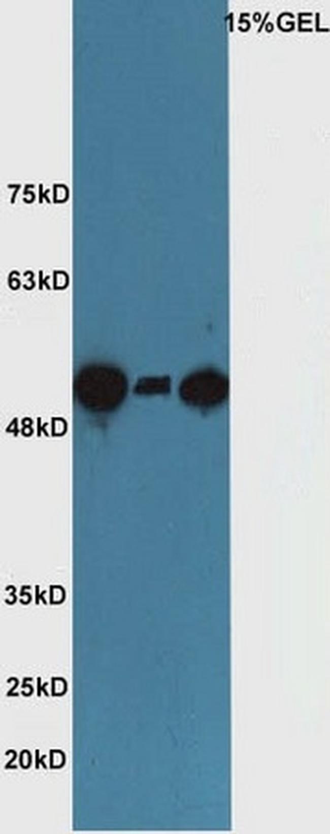 SUFU/Suppressor of Fused Antibody in Western Blot (WB)