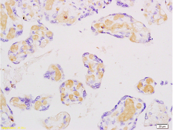 FLIP Antibody in Immunohistochemistry (Paraffin) (IHC (P))