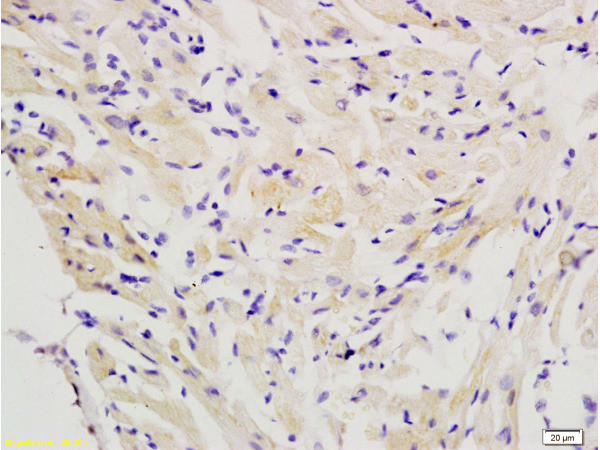 FLIP Antibody in Immunohistochemistry (Paraffin) (IHC (P))