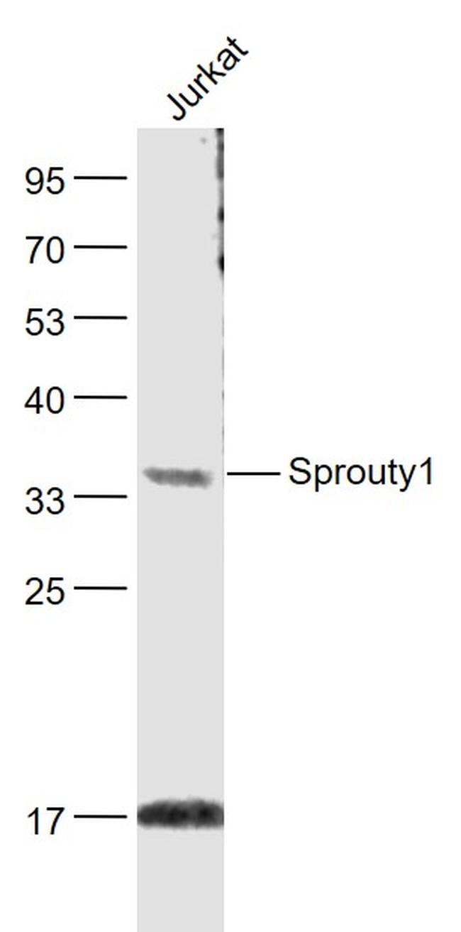 Sprouty1 Antibody in Western Blot (WB)