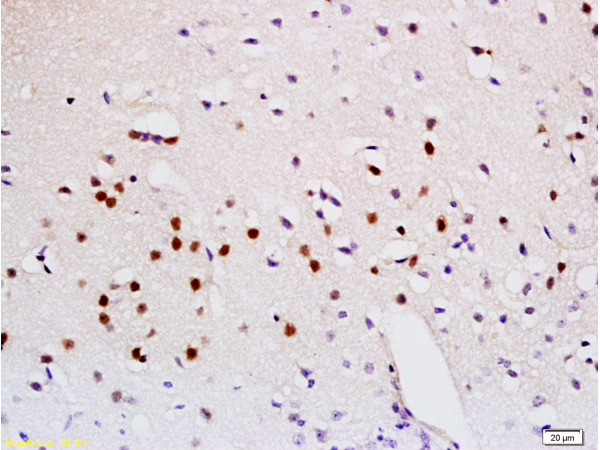 Sema3A Antibody in Immunohistochemistry (Paraffin) (IHC (P))