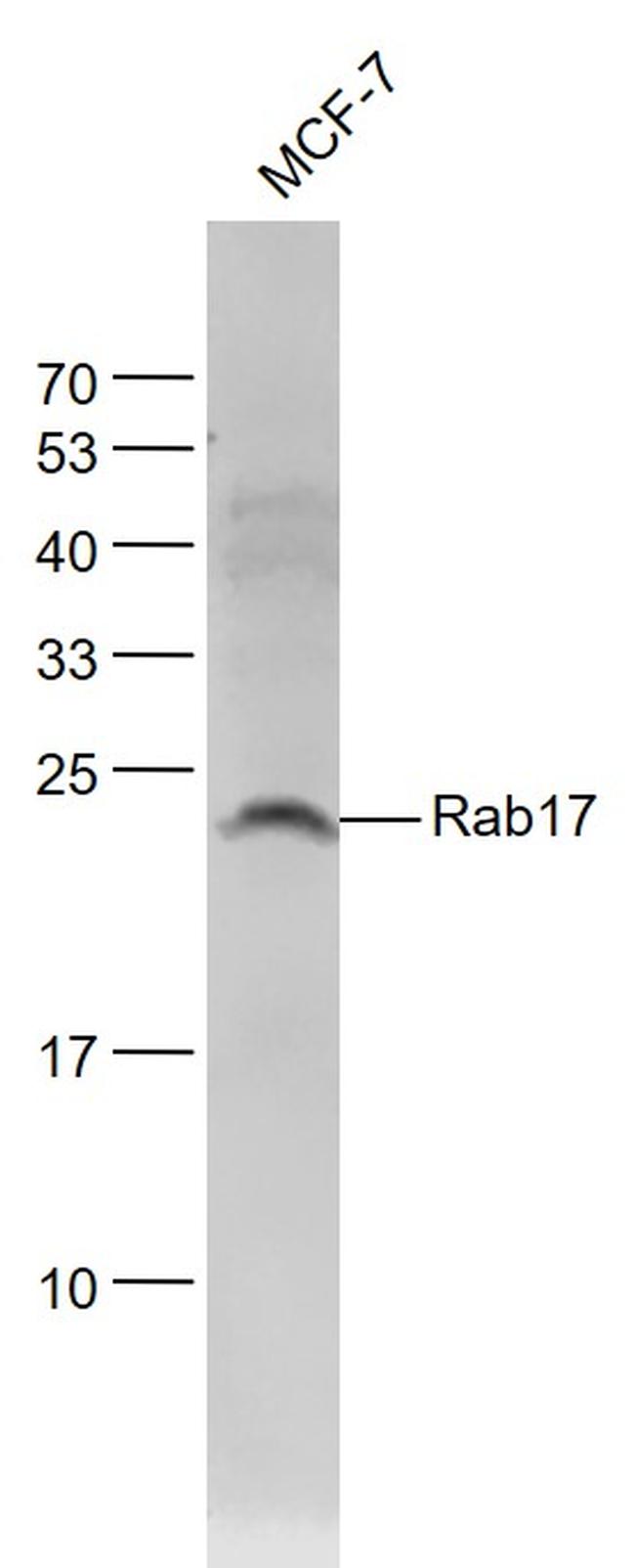 Rab17 Antibody in Western Blot (WB)