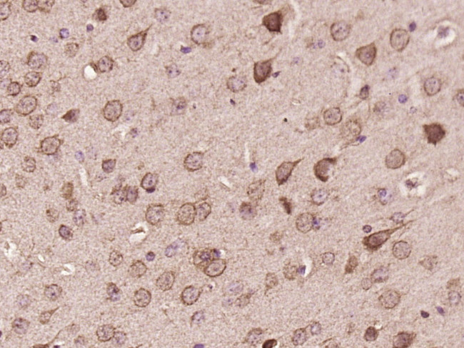 TMP21 Antibody in Immunohistochemistry (Paraffin) (IHC (P))