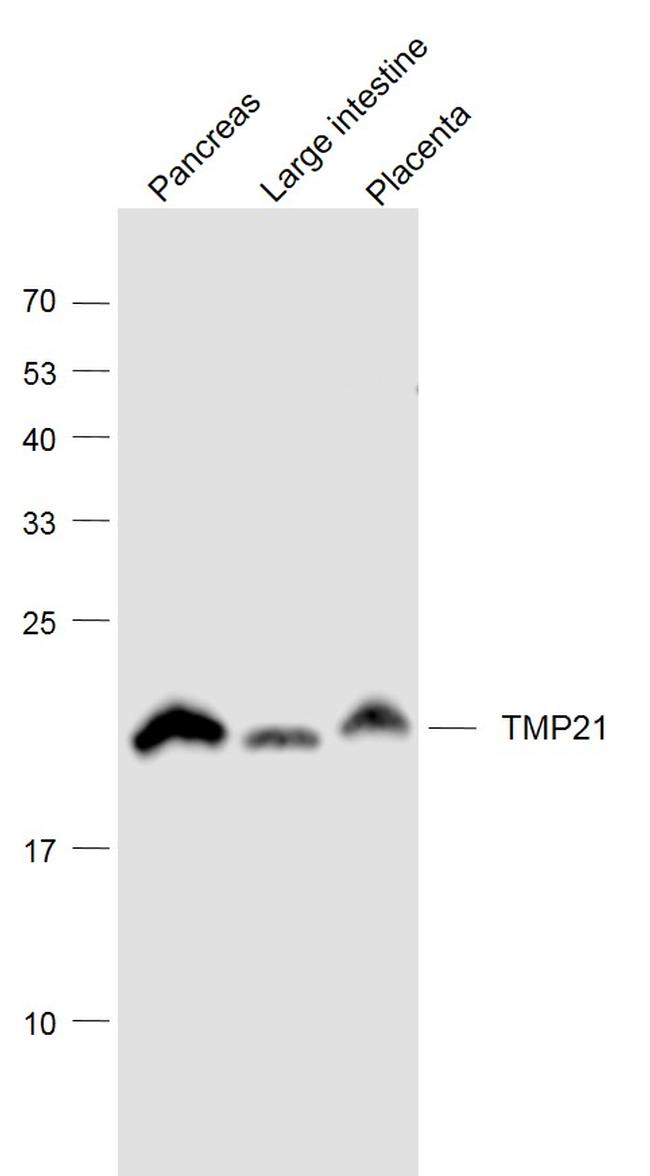 TMP21 Antibody in Western Blot (WB)