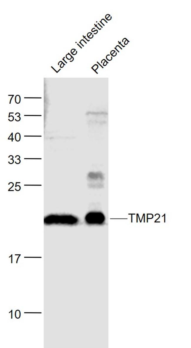 TMP21 Antibody in Western Blot (WB)