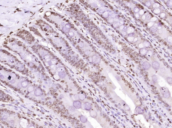 MYO6/Myosin VI Antibody in Immunohistochemistry (Paraffin) (IHC (P))