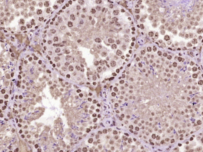 MYO6/Myosin VI Antibody in Immunohistochemistry (Paraffin) (IHC (P))