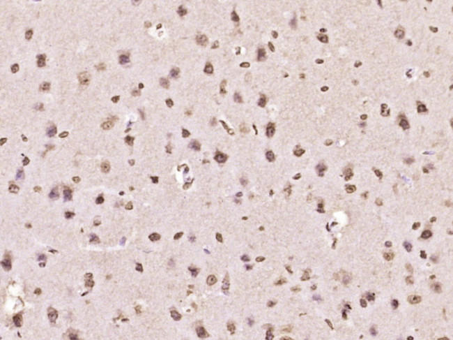 MYO6/Myosin VI Antibody in Immunohistochemistry (Paraffin) (IHC (P))