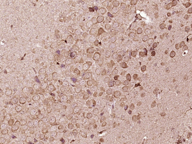 FKBP51 Antibody in Immunohistochemistry (Paraffin) (IHC (P))