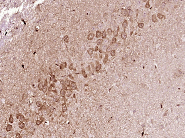 FKBP51 Antibody in Immunohistochemistry (Paraffin) (IHC (P))