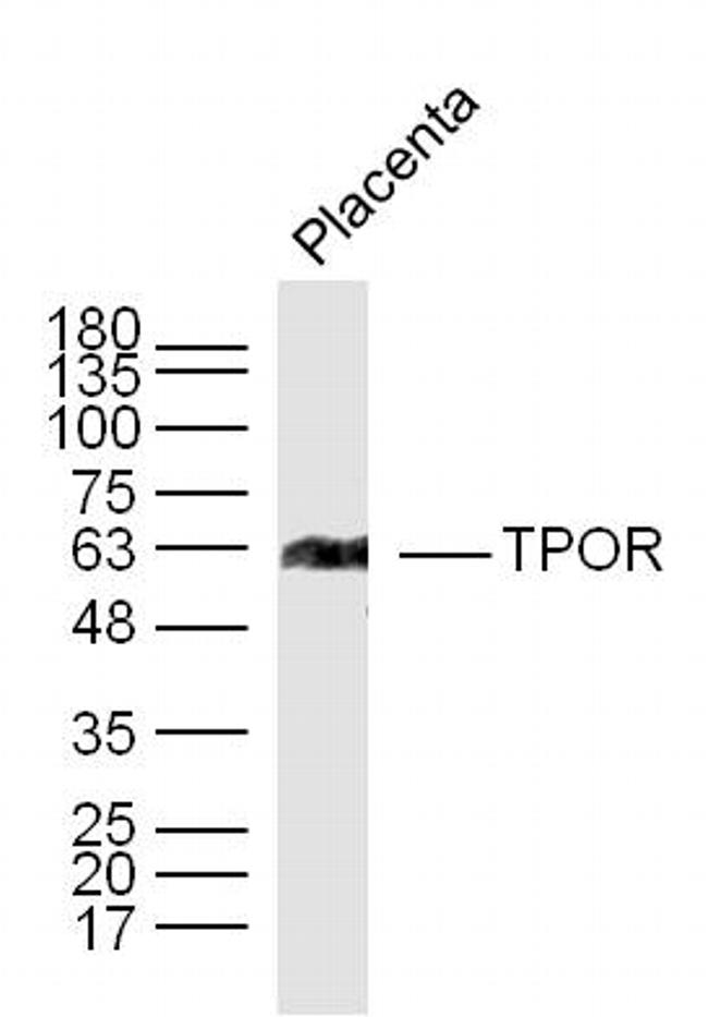 TPOR Antibody in Western Blot (WB)