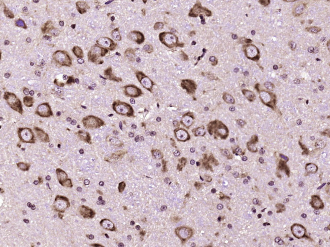 PTPN5/STEP Antibody in Immunohistochemistry (Paraffin) (IHC (P))