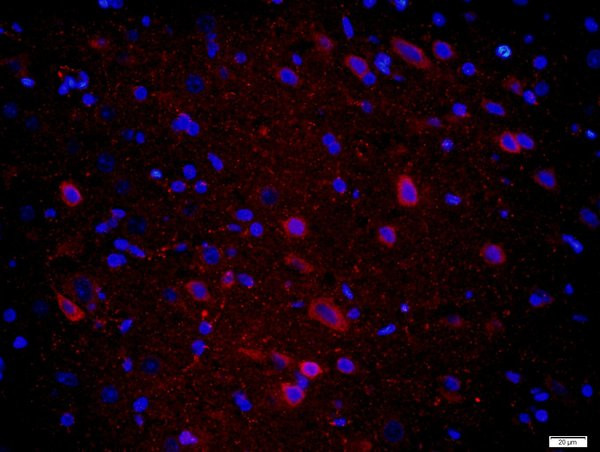 CPLX1 Antibody in Immunohistochemistry (Paraffin) (IHC (P))