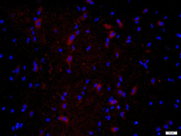 CPLX1 Antibody in Immunohistochemistry (Paraffin) (IHC (P))