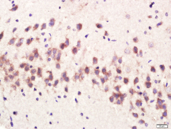 CPLX1 Antibody in Immunohistochemistry (Paraffin) (IHC (P))