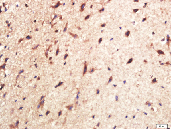 CPLX1 Antibody in Immunohistochemistry (Paraffin) (IHC (P))