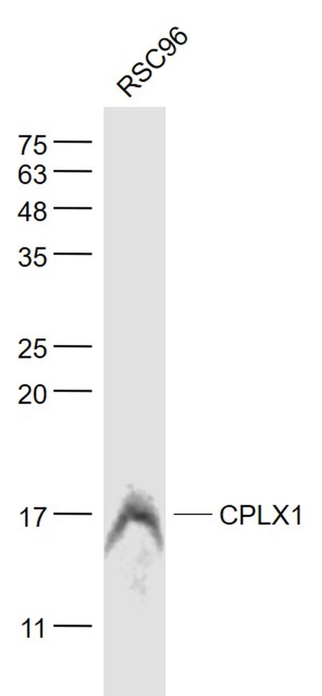 CPLX1 Antibody in Western Blot (WB)