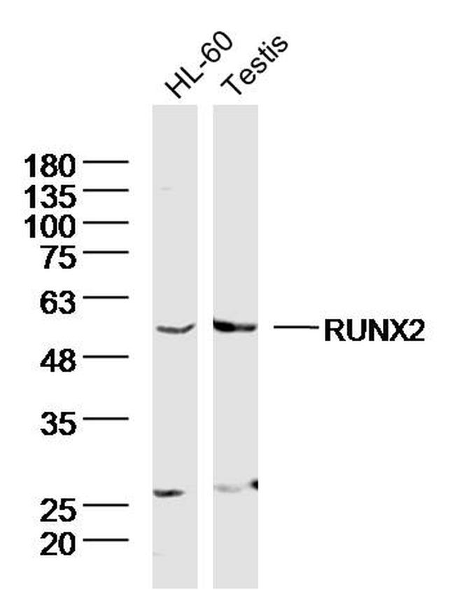 RUNX1/RUNX2 Antibody in Western Blot (WB)