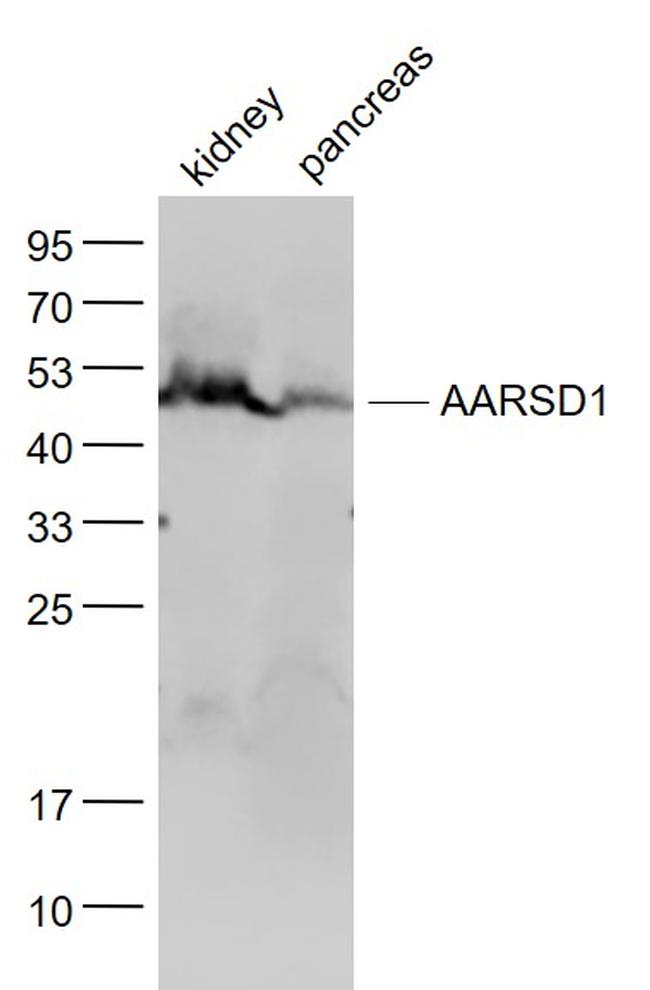 AARSD1 Antibody in Western Blot (WB)