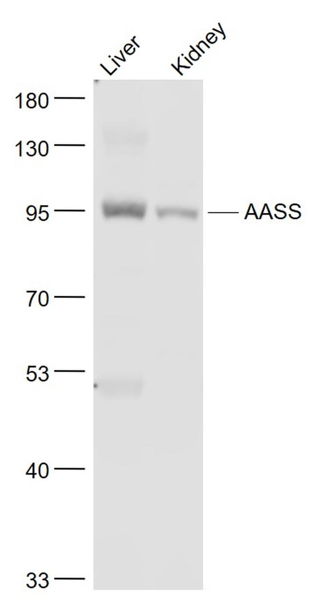 AASS/LKRSDH Antibody in Western Blot (WB)