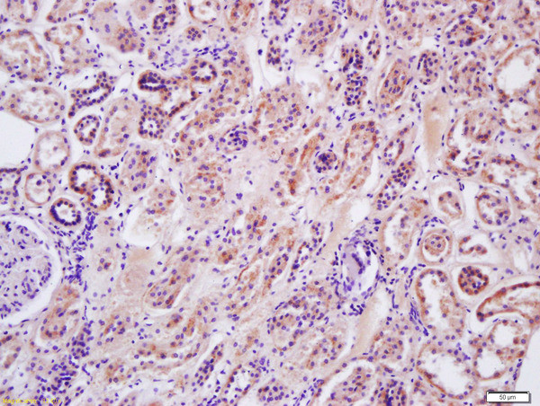 Arginase 2 Antibody in Immunohistochemistry (Paraffin) (IHC (P))