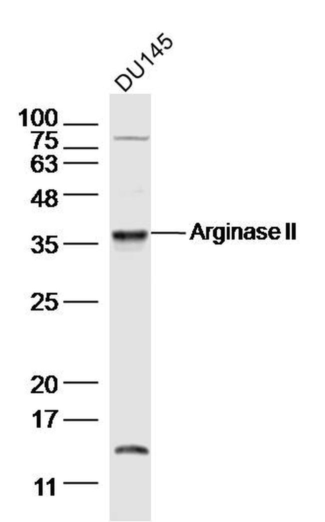 Arginase 2 Antibody in Western Blot (WB)