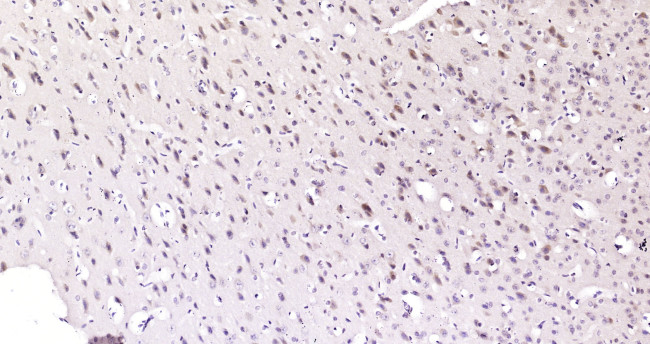 AKR1C3/DD3 Antibody in Immunohistochemistry (Paraffin) (IHC (P))