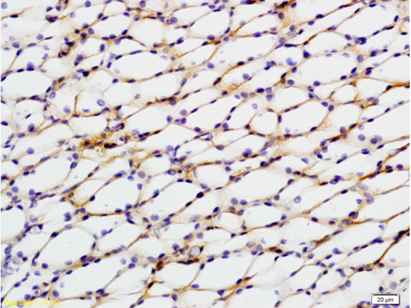 STAT2 Antibody in Immunohistochemistry (Paraffin) (IHC (P))