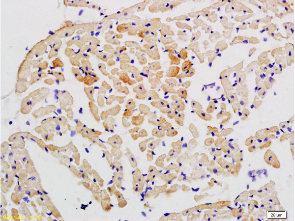 STAT2 Antibody in Immunohistochemistry (Paraffin) (IHC (P))