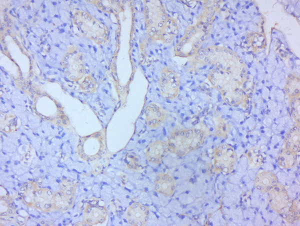 STAT2 Antibody in Immunohistochemistry (Paraffin) (IHC (P))