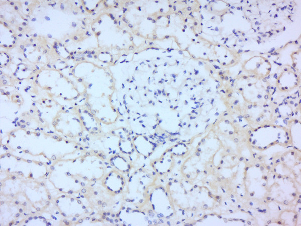 STAT2 Antibody in Immunohistochemistry (Paraffin) (IHC (P))