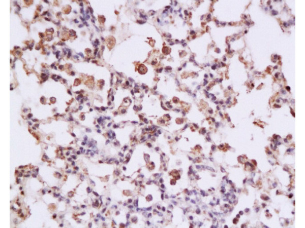 STAT3 Antibody in Immunohistochemistry (Paraffin) (IHC (P))