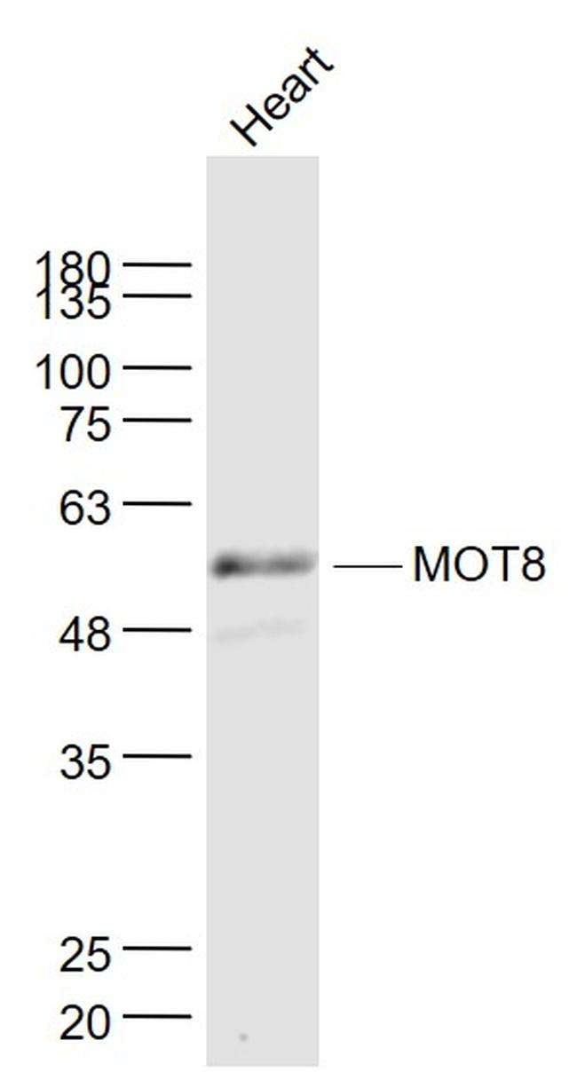 MOT8/SLC16A2 Antibody in Western Blot (WB)