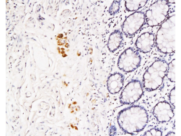 TFPI-2 Antibody in Immunohistochemistry (Paraffin) (IHC (P))